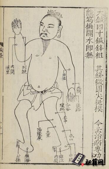 中医古籍.医学统宗.五册.明.何柬辑.明隆庆三年刊本
